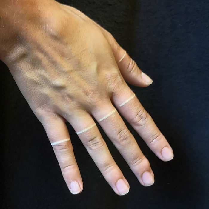 Hai mai notato la bellezza dei tatuaggi bianchi? Hai mai notato la bellezza dei tatuaggi bianchi?